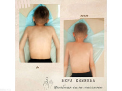 Детский и взрослый массажист с 20-летним опытом работы, Арапова Вера Валерьевна. - 4/9